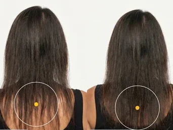 Antes/Después