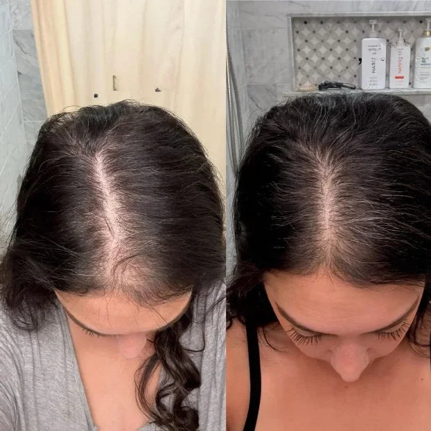 Pelo nuevo donde antes no había nada