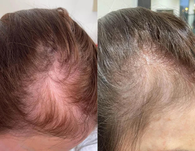 Mi dermatóloga me las recomendó